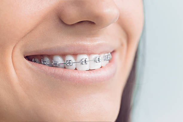 Best Invisalign and Clear Aligners  in Cornell, WI